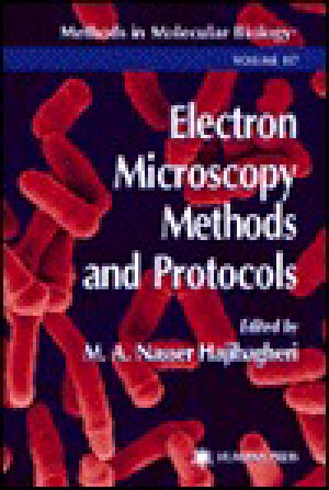 [Methods in Molecular Biology 117] • Methods in Molecular Biology, Volume 117 · Electron Microscopy Methods and Protocols